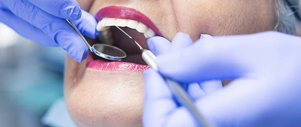 Best Emergency Dentist for Lost Fillings or Crowns in Casper, WY