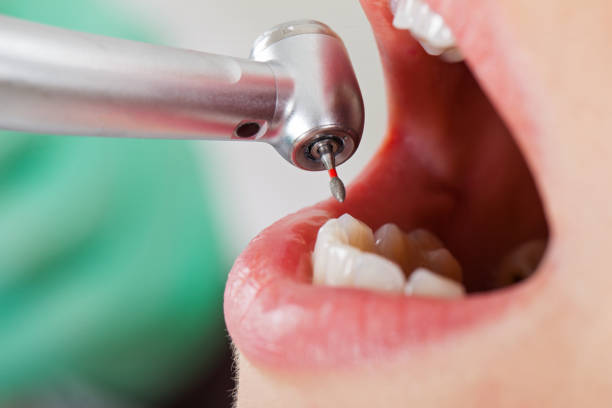 Fast & Reliable Emergency Dental Services in WY